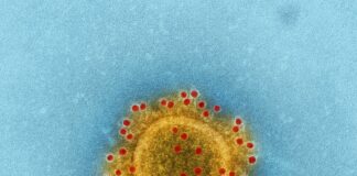 a yellow substance with red dots in it