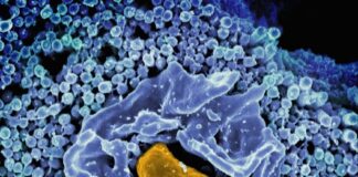 a cell with two yellow cells inside of it