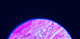 a close up of a section of a human's stomach