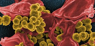 a close up of a red and yellow substance