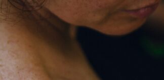 A close up of a woman with freckles on her arm