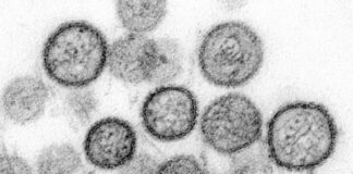 Microscopic view of spherical viruses with surface spikes.
