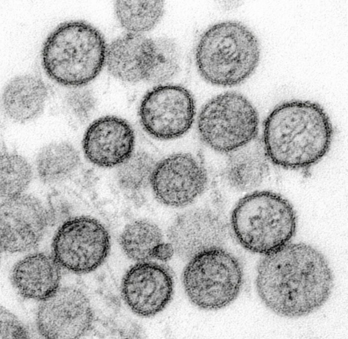 Microscopic view of spherical viruses with surface spikes.