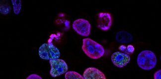 purple cells